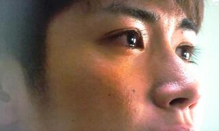 毛穴黒ずみが鼻や頬にあるような男は恋愛対象外ですよね ケ Yahoo 知恵袋