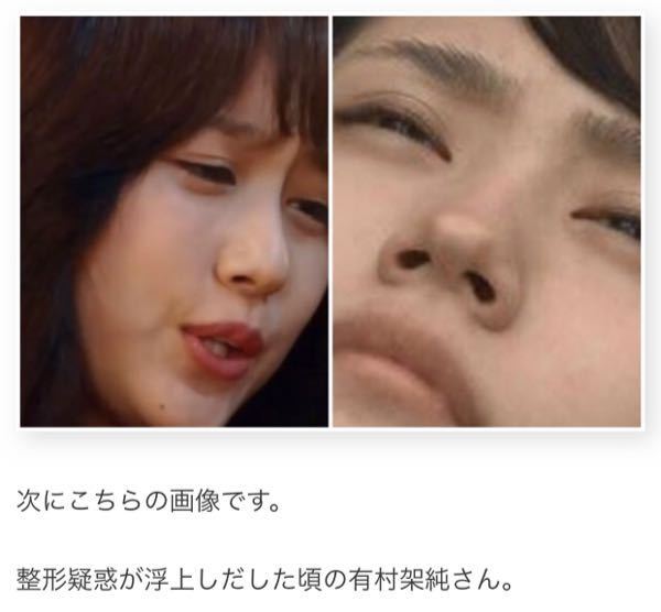 新垣結衣   鼻 これ、鼻をいじってますよね？新垣結衣でもするんだね - 女優のほとん... - Yahoo!知恵袋