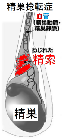 今朝からちんこの皮がむくんでます 変色 痛みなどなく 膨張した感じで Yahoo 知恵袋