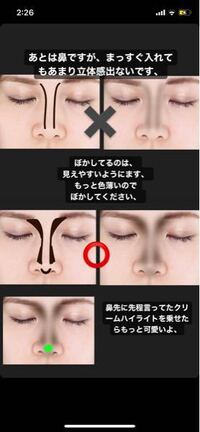 鼻について わたしの鼻は 豚鼻です 豚鼻を治す器具などがあ Yahoo 知恵袋