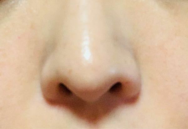 イチゴ鼻じゃない人は存在しますか 多くの人が悩む鼻の毛 Yahoo 知恵袋