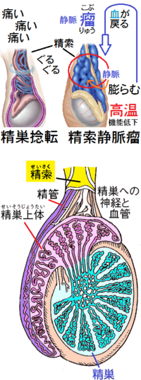 今18歳なのですが 右の睾丸の横に小豆の粒くらいのしこりがありま Yahoo 知恵袋