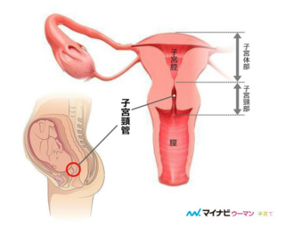 妊娠16 17週で子宮頚管33mmとは 危険度はどのような状 Yahoo 知恵袋