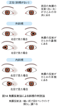 こんにちは 私は小さい頃から斜視です 集中すると両目で相手を見て話すこと Yahoo 知恵袋