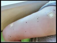 ほくろフェチの人ってどう思いますか 特にお腹にあるホクロが Yahoo 知恵袋