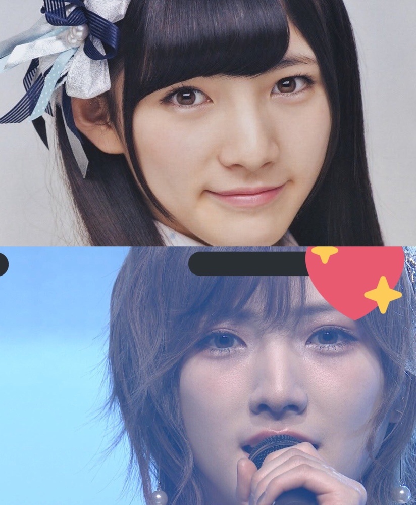 整形に詳しい方に質問です Akb48の岡田奈々ちゃんって昔のロン Yahoo 知恵袋