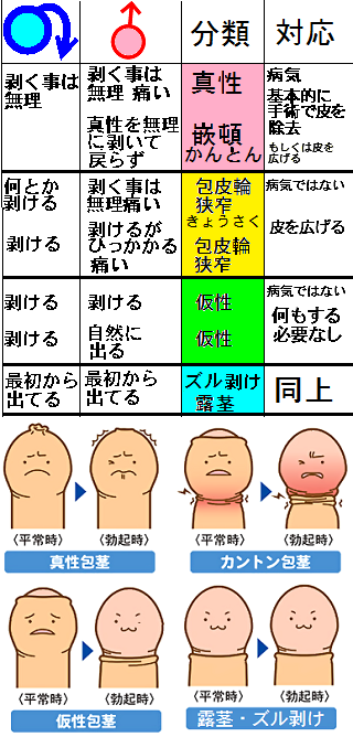 露茎写真