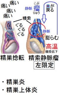 画像の丸で囲んだ辺りが痛みます 睾丸からの痛みのような気がし Yahoo 知恵袋