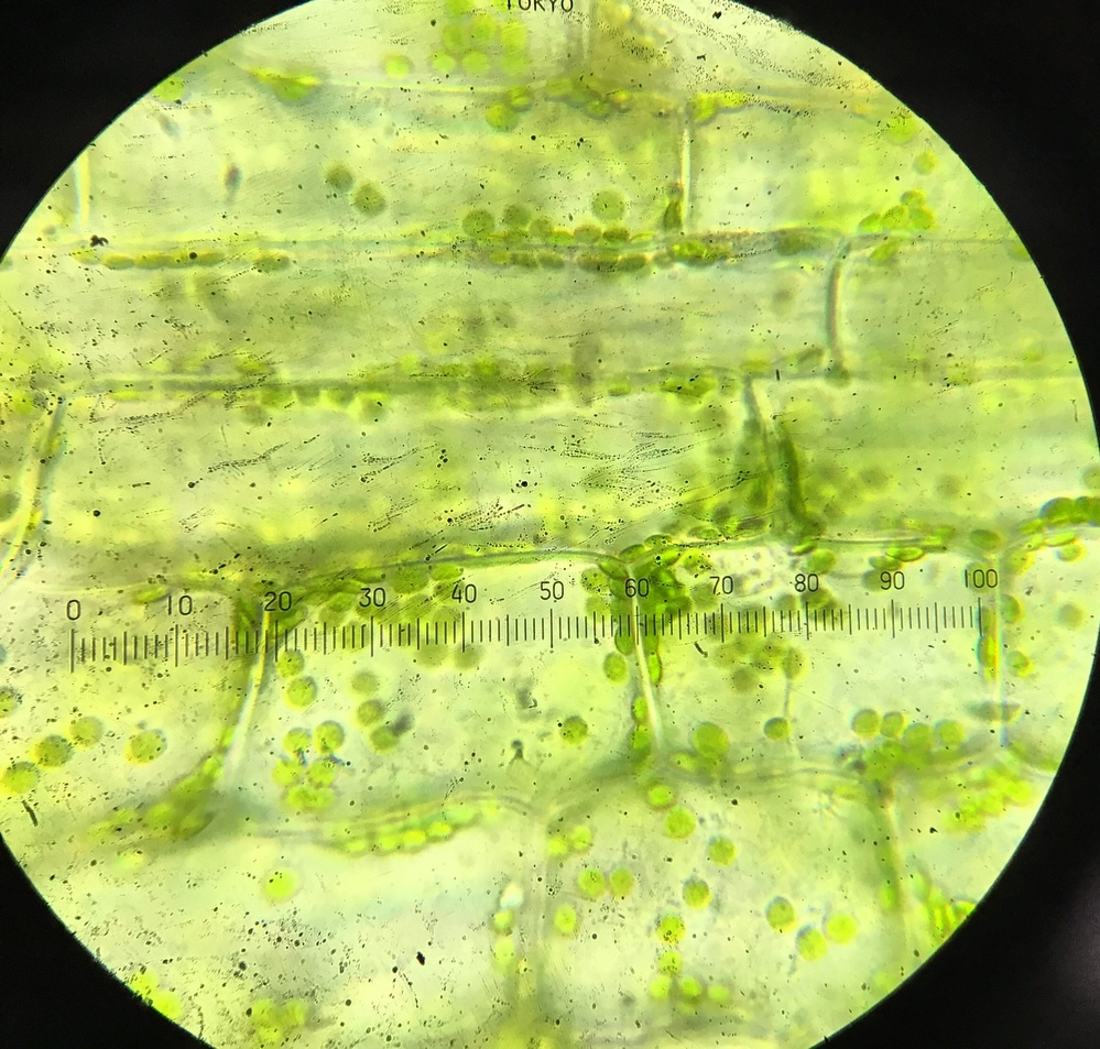 イシクラゲとオオカナダモの細胞の特徴、ちがい、葉緑体の大きさ 