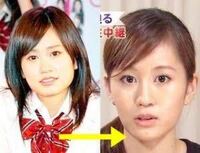 頬骨とエラを目立たなくするには骨を削る以外すべは無いでしょうか Yahoo 知恵袋