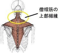 どうしたらいかり肩をなで肩に近づけることができますか 僧帽筋 Yahoo 知恵袋