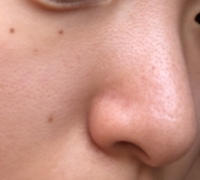 肌がゴワゴワとはどんな感じですか ゴワゴワとか言われてもいまい Yahoo 知恵袋