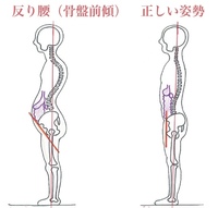 懸垂って猫背矯正に効果ありますか Yahoo 知恵袋