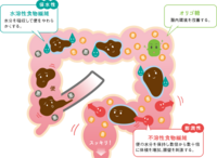 矛盾 ヴィーガン