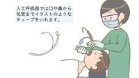 Icuに入り意識がありません 人工呼吸器を付けています そう Yahoo 知恵袋