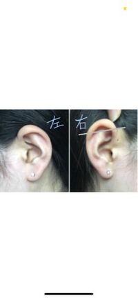 ピアス初心者です ロブ3連 インダストリアルにピアスを開けたいと思って Yahoo 知恵袋