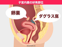 性交渉最中痛みがあり その後腹痛下痢があります 何かの病気なのでしょう Yahoo 知恵袋