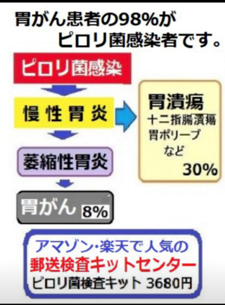 バリウム 拒否 診断 健康