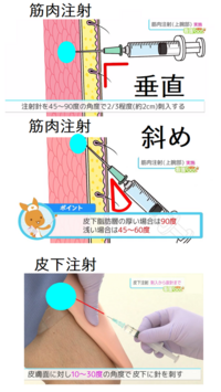 新型コロナのワクチン接種は 筋肉注射のようですが 腕の筋肉に何cmくらいの深さ Yahoo 知恵袋