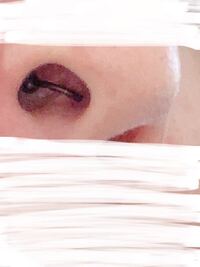 セプタム開けた方にお聞きしたいです 初めてニードルを使ってあげるんですが注意 Yahoo 知恵袋