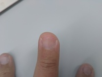 ギターを弾くとチョーキングをした時に爪の下の皮が爪から剥がされてしまって爪の Yahoo 知恵袋