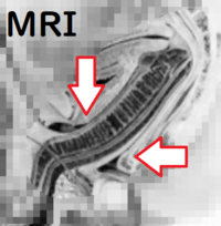 昨日 初体験をしました 挿れときや されている最中は少し痛いくらいだ Yahoo 知恵袋
