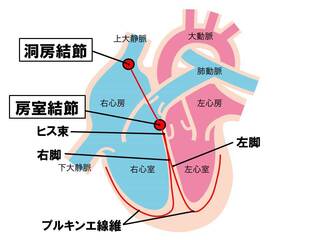 洞結節って上大静脈と右心房のつながってるところ辺りにありますか Yahoo 知恵袋