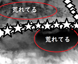 画像閲覧注意 亀頭包皮炎でしょうか 病院で2回診察して塗り薬をもらい Yahoo 知恵袋