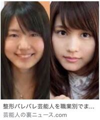 1000以上 整形してる芸能人画像