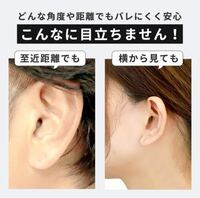 先月ピアスを開けて 先週ファーストピアスからセカンドピアスに付け替え Yahoo 知恵袋