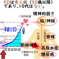 ペイロニー病による勃起不全