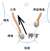 寝起きの時に睾丸が赤い部分のところまで上がってきて挟まってる ことがある Yahoo 知恵袋