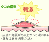 私はお風呂の中で鼻くそをもう 全力で取る派です 毎日一日二回ぐらい鼻小さく Yahoo 知恵袋