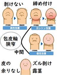 包茎について 大学1年です自分がかんとん包茎 というやつかも Yahoo 知恵袋