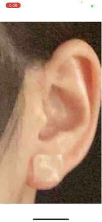 はじめてのピアスの穴を開けたいんですけど バイト先がピアス禁止で隠した Yahoo 知恵袋