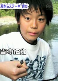 菅田将暉さんの鼻 してないと本人は訴えていますが やはりしてるのかな Yahoo 知恵袋