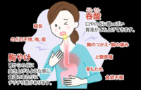 10代後半男です 逆流性食道炎の疑いでタケキャブを処方してもらい5日程経ちます Yahoo 知恵袋