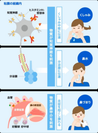 鼻づまりについてです 毎日鼻詰まってるとかはないんです Yahoo 知恵袋
