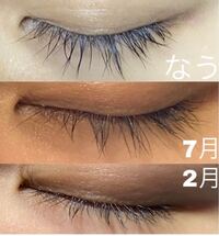 まつ毛美容液って効果ありますか 本当にまつ毛伸びたり増 Yahoo 知恵袋