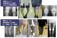 足を縛って寝るo脚矯正の為に足を縛って寝る というのを実践し Yahoo 知恵袋