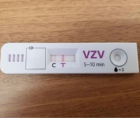 発疹が出てから３日目医者に帯状疱疹に見えないから帯状疱疹じゃないと言われたら間 Yahoo 知恵袋