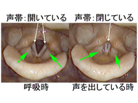声帯と仮声帯の違いを教えてください。声帯閉鎖とは仮声帯を閉じ... - Yahoo!知恵袋