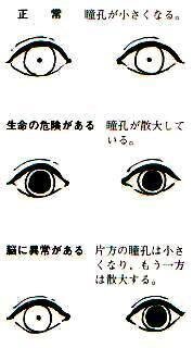 瞳孔が開くってどんな状態ですか こんな感じです 通常は小さく Yahoo 知恵袋