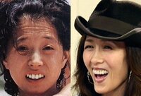 人間歯を抜くと体に支障が出ると言いませんか 工藤静香や中森明菜は Yahoo 知恵袋