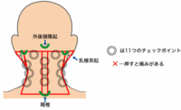 最近 左の耳後ろ 首と頭の付け根 が痛く少し腫れています こめかみや頭に Yahoo 知恵袋