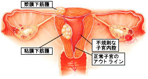 血 みたい 生理 レバー な