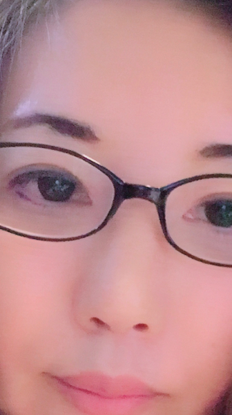 ノーズクリップを使うと 鼻が肥大化したり にきび鼻になったりと Yahoo 知恵袋