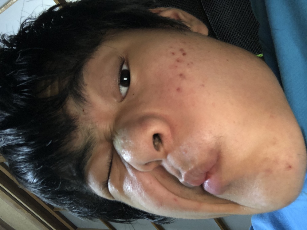 場面緘黙症って嫌われますよね 私は中３まで場面緘黙症でした 両親 Yahoo 知恵袋