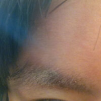 眉毛からフケが出ます もともと頭皮のフケ かゆみがひどくて 最近で Yahoo 知恵袋