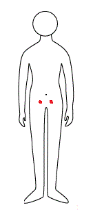 下腹部の違和感 股間の上部10cm程の所 画像の赤い部分 Yahoo 知恵袋